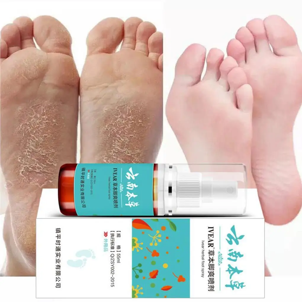 55ml Athlete’s Foot Spray Liquid Smelly Feet Spray Foot Spray For Athlete’s Foot Treatment Smelly Feet therapy