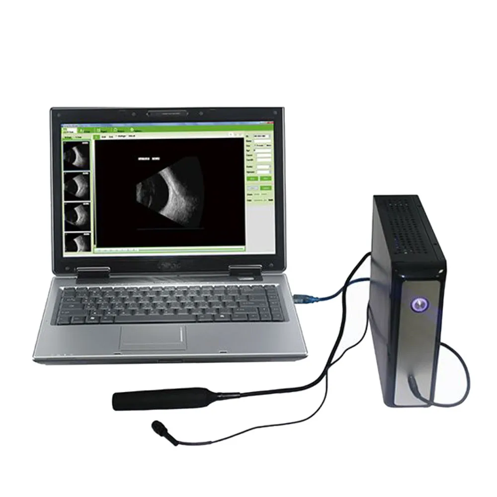 Hot Sale HO-200 A / B Ophthalmic LED Ultrasound Scanner for Biometry Eye Test in Ophthalmology