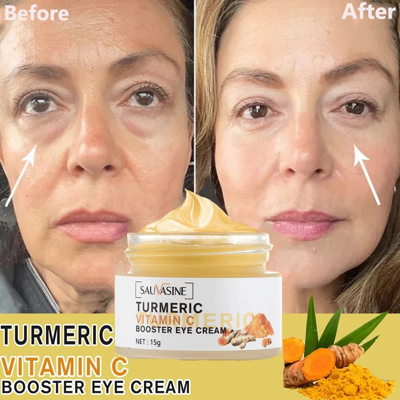 

Turmeric Eye Cream Remove Dark Circles Eye Bags Anti-Wrinkle Fades Fine Lines Vitamin C Anti Puffiness Firm Brightening Eye Care