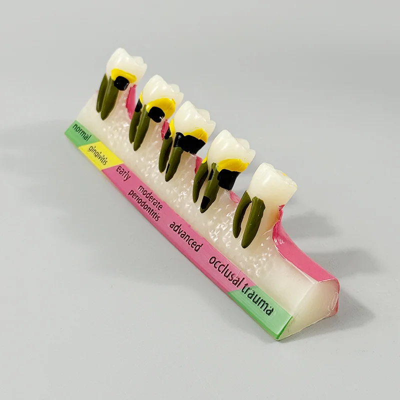 

Стоматологическая модель, модель зуба, модель зуба, стоматологическая обучающая модель для стоматолога, обучение, обучение, доктор-пацієнт, коммуникация