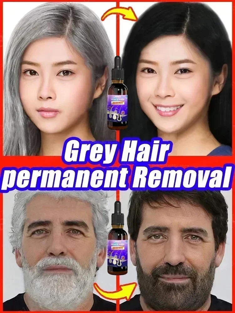 Anti grey Hair Serum treatment Remedy White oscuring Hair White To Black Natural Color Repair prodotti nutrienti per la cura dei capelli