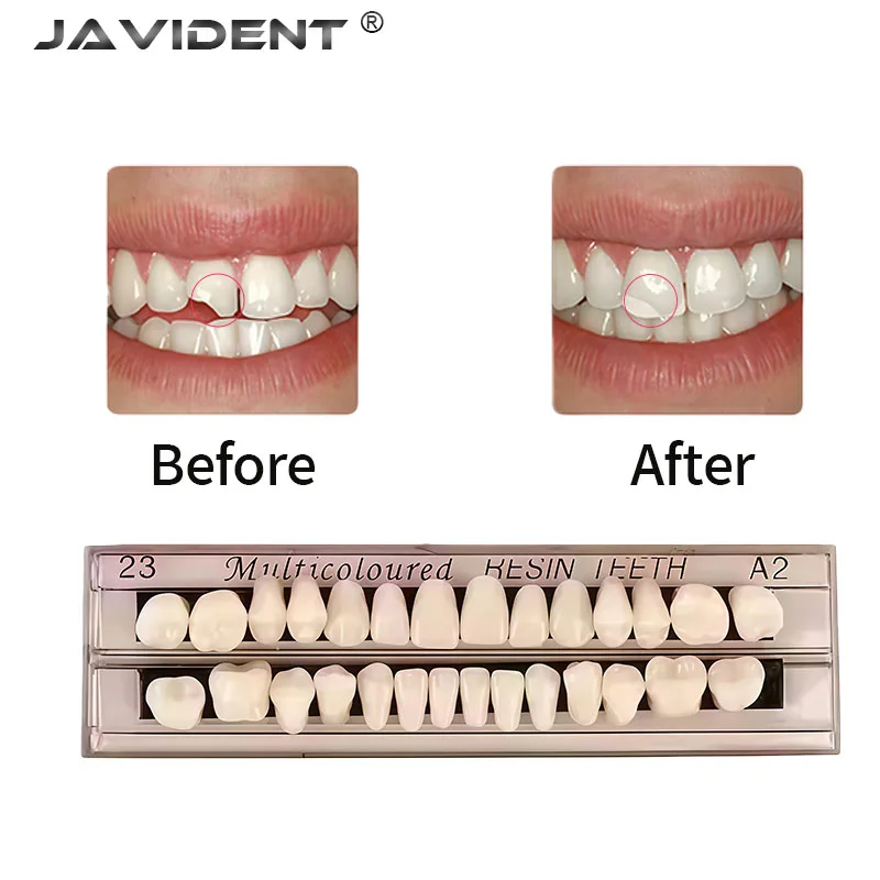 1Pcs Dental Resin Shade Guide Highly Wear-Resistant Dental Granules Denture Component Teaching Model Oral Dental Instruments