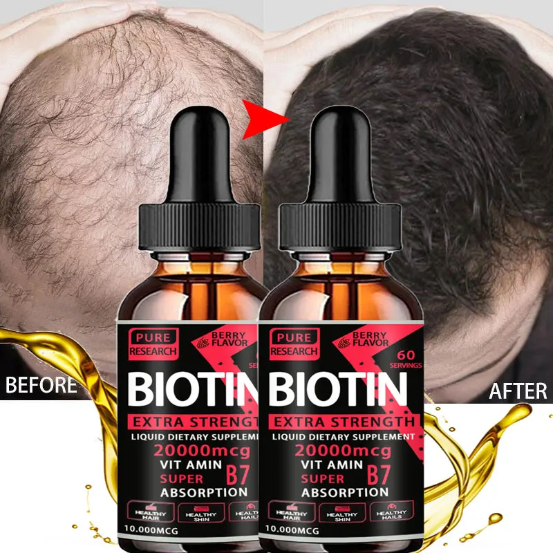 Fast Hair Growth Oil Hair Regeneration Essence Hair Thinning Treatment Hair Growth Fluid Anti-Hair Loss Care for Men and Women