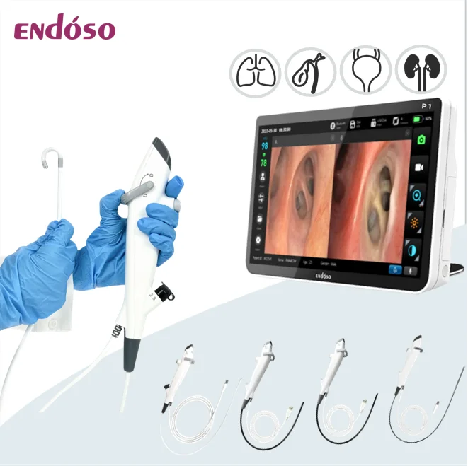 Endoscope 720P Flexible Fiberoptic Bronchoscope With USB Lemo Connector