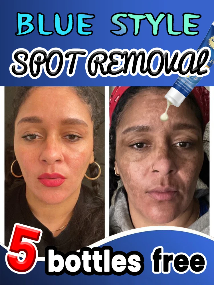 

New Hot-Selling Products for Effective Spot Removal and Facial Treatments