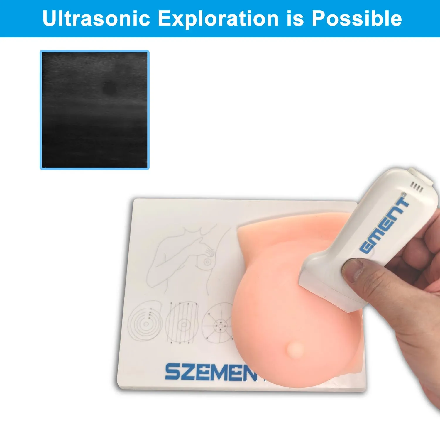 Breast Nodule Palpation Training Model Breast Lesions Palpation of Nodules Can Be Visualized By Ultrasound Mammary Gland Palpate
