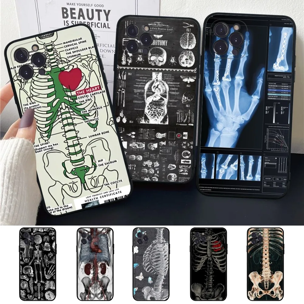 Radiological Human Organs Skeleton Skull Phone Case For IPhone 14 11 12 13 Mini Pro XS Max Cover 6 7 8 Plus X XR SE Funda Shell