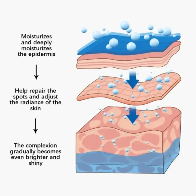 كريم النمش الفعال يضيء الوجه بسرعة إزالة الكلف البقع الداكنة تتلاشى الميلانين تبييض المضادة للتصبغ تحسين بلادة #6