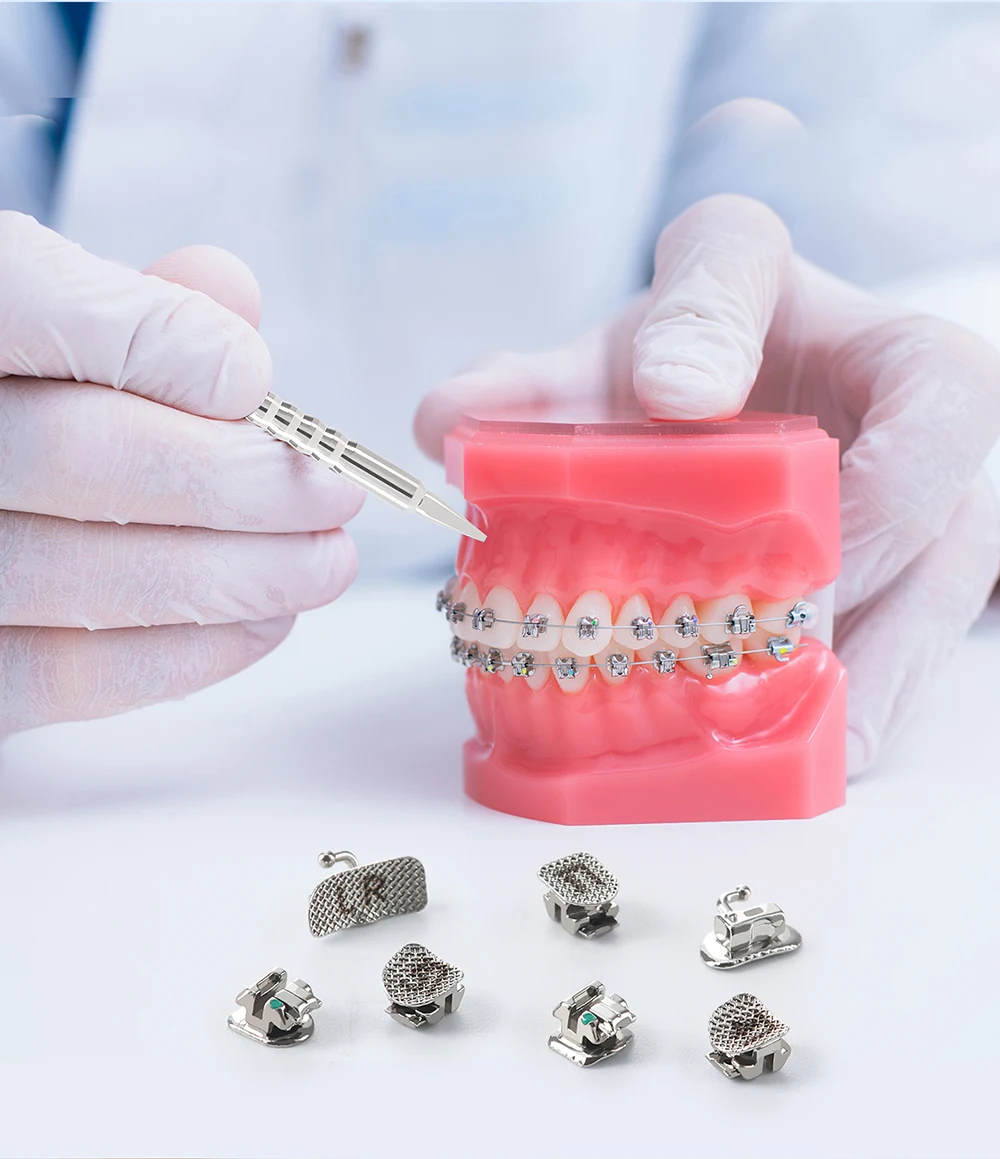 AZDENT Kieferorthopädische selbstligierende Metallhalterungen mit Bukkalröhrchen Roth 022, MBT 022, Haken 3–4–5 bewegliche und silberne Werkzeuge Dental – Detail 9