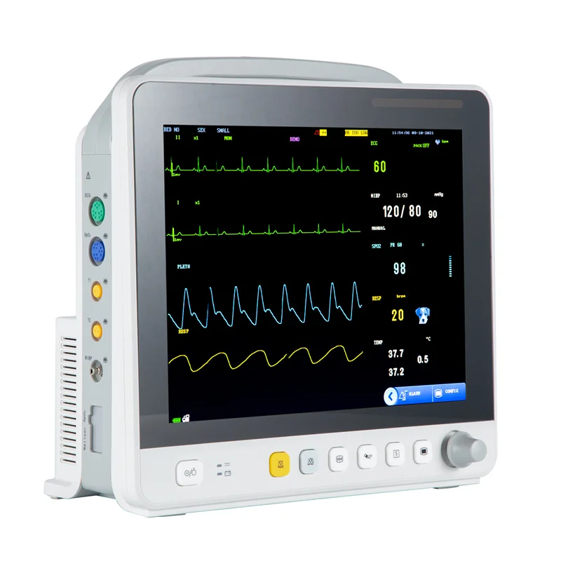 YK-VE12 vet monitor touch screen ECTO2 animal veterinary multiparameter monitor cardiac monitor bulit-in printer