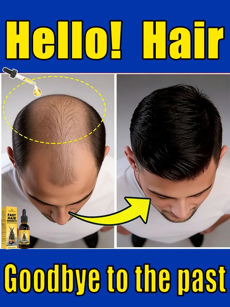 

Масло будущего Magic Hair Growth пробуждает фолликулы для волос в общежитии, превращающие пустыри в плотные леса!