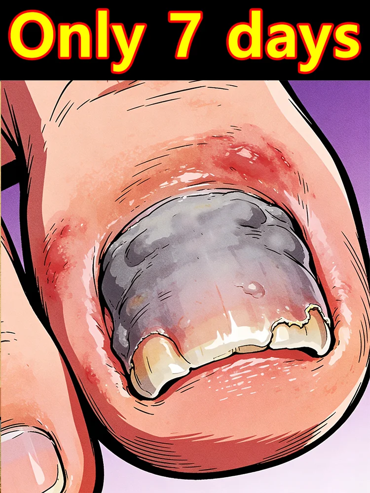 Hot Sale Nail Health Care Oil Damaged Nail Restoration Manicure Tool The Most Popular in 2026