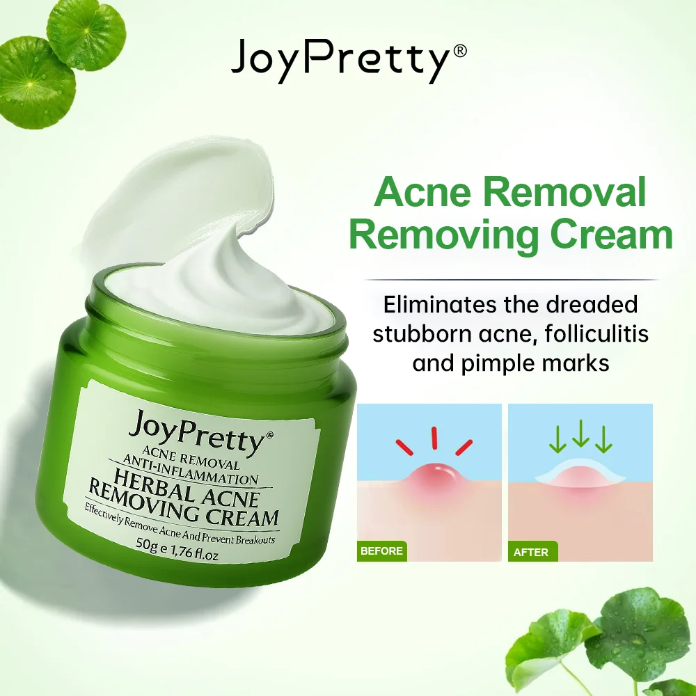 

JoyPretty Herbal Acne Treatment Face Cream Elimination Large Pores Oil Control Shrink Pore Facial Cream Skin Care Beauty Health