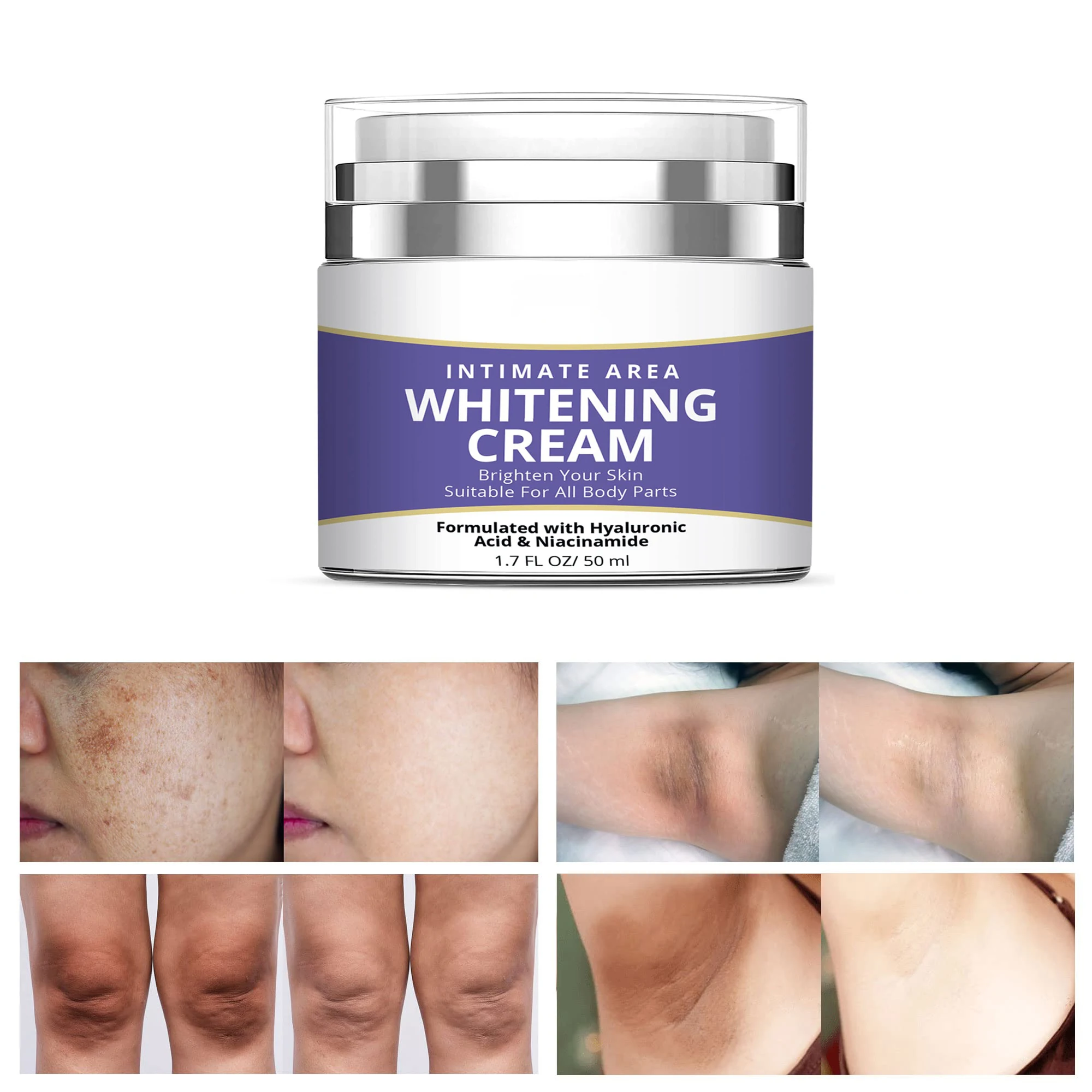 Intimate Area Whitening Cream Brighten Skin Suitable For All Body Parts Pigmentation Melasma Remover Skin Whitening Body Cream