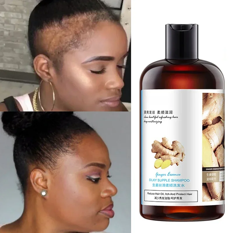 Chebe Shampoo Hair Growth Serum Anti Preventing Hair Loss Alopecia Liquid Damaged Hair Repair Growing conditioner mask