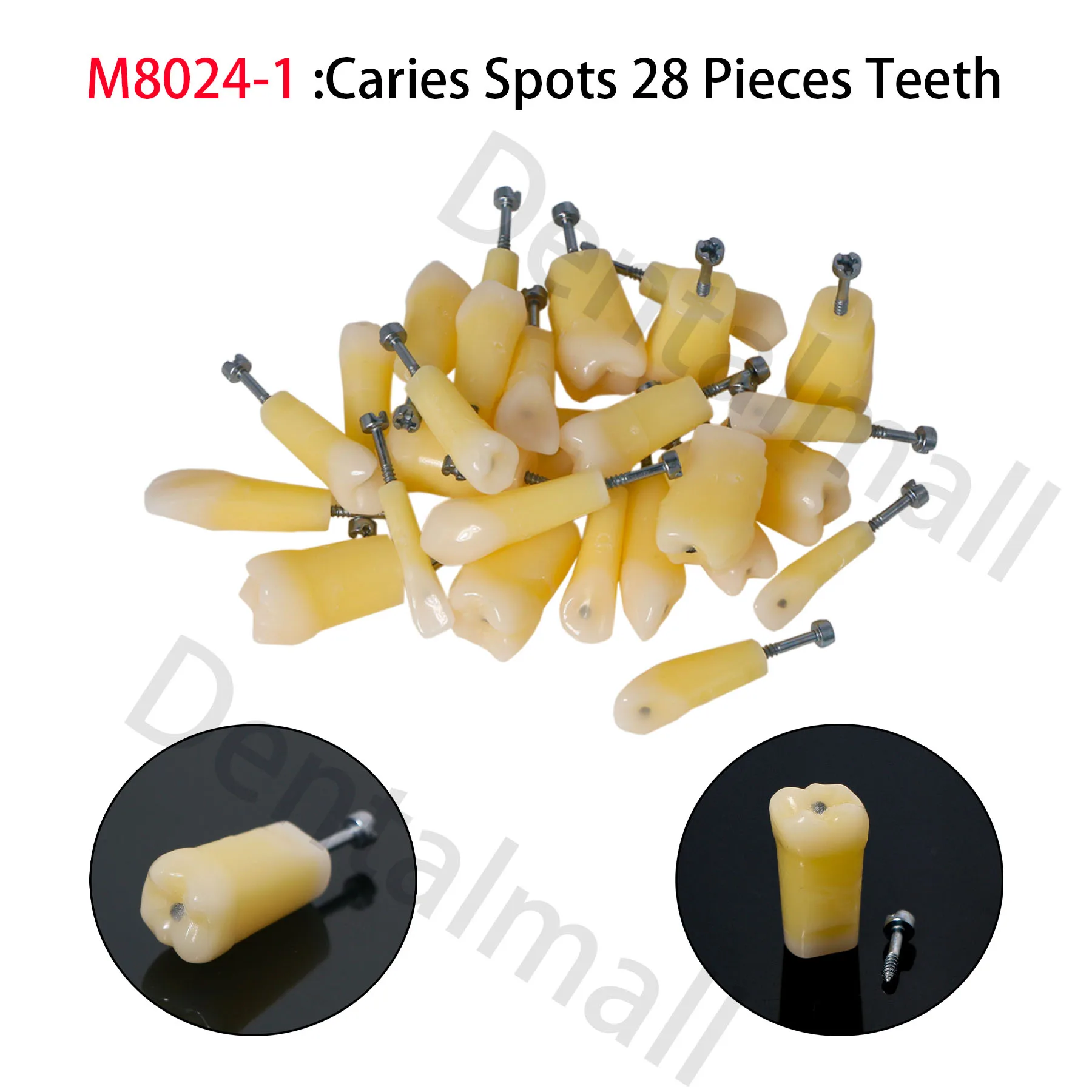 Dental Teeth Model Caries Spots Molar Vitro Teeth Decay Caries Dentist Tooth Student School 3PCS M8024-1