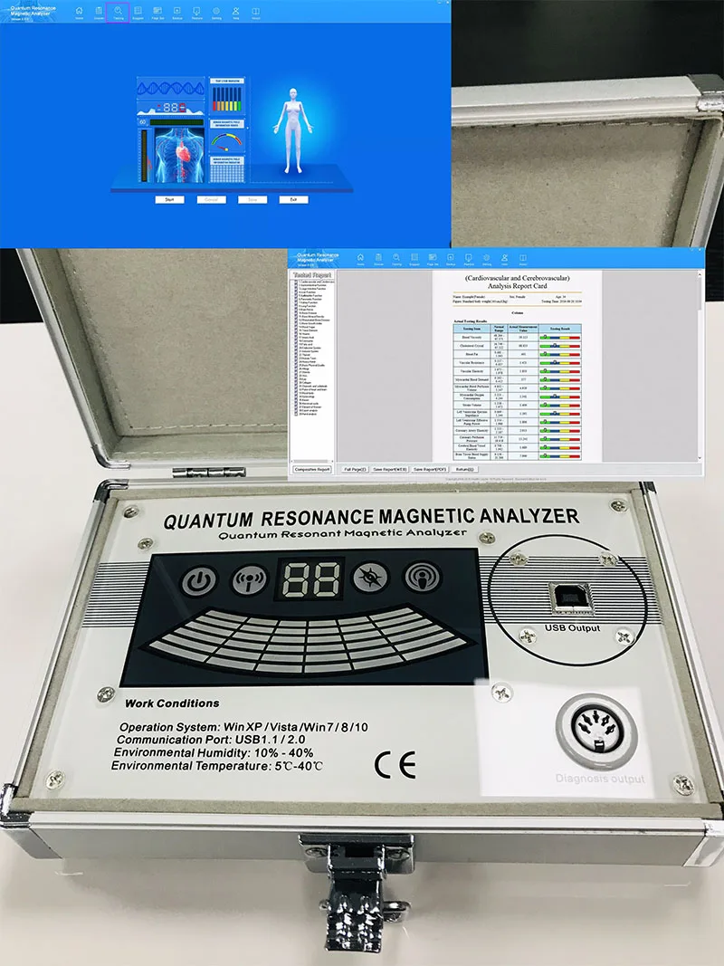 Mini Quantum Analyzer 2025 Upgrade Version Software Detection Stick Model Health Analyzer Vitamin Minerals 53 Reports
