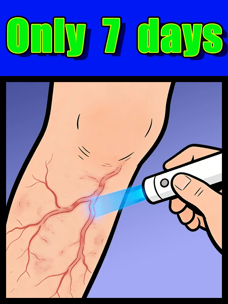 Help people with vein problems caused by prolonged standing. Restore mobility. No side effects Unisex free shipping
