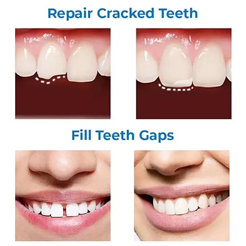 Kit de reparación de dientes falsos para reparación Oral, cuentas de reparación de dientes falsos de grado alimenticio, pegamento sólido