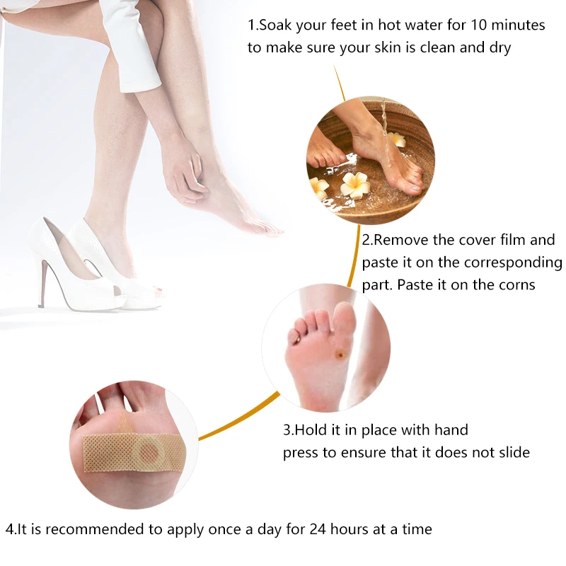 Patch médico para Foot Care, Remoção de gesso, Corn Removal Pads, curativos Patches, Calos Remover, Calosidade Detox, Summer Tools, 6PCs