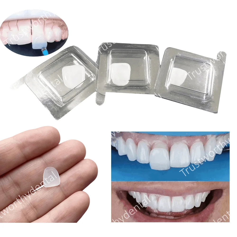 Dental Composite Porcelain Veneer Whitening Front Teeth Upper Lower Veneers Bright White Dentistry Restoration Materials