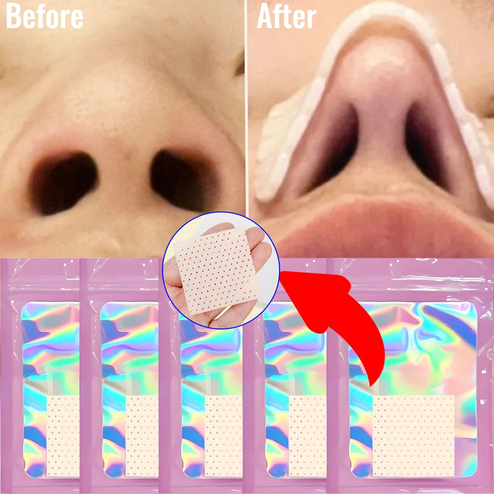

1/5PCS Reusable Thermoplastic Nose Clip Breathable Nose Bridge Height Corrector Shrinking Nasal Wing Stickers Health Care Brace