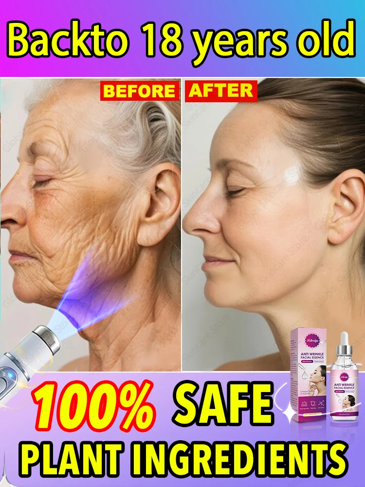 Laser Product For Solves wrinkle Problems