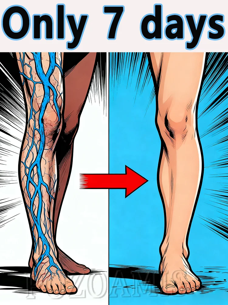 About Varicose Vein Body Care