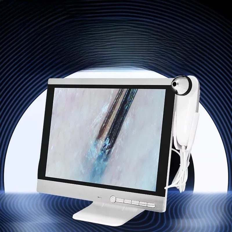 High definition scalp detector display screen integrated screen instrument hair follicle skin detection instrument