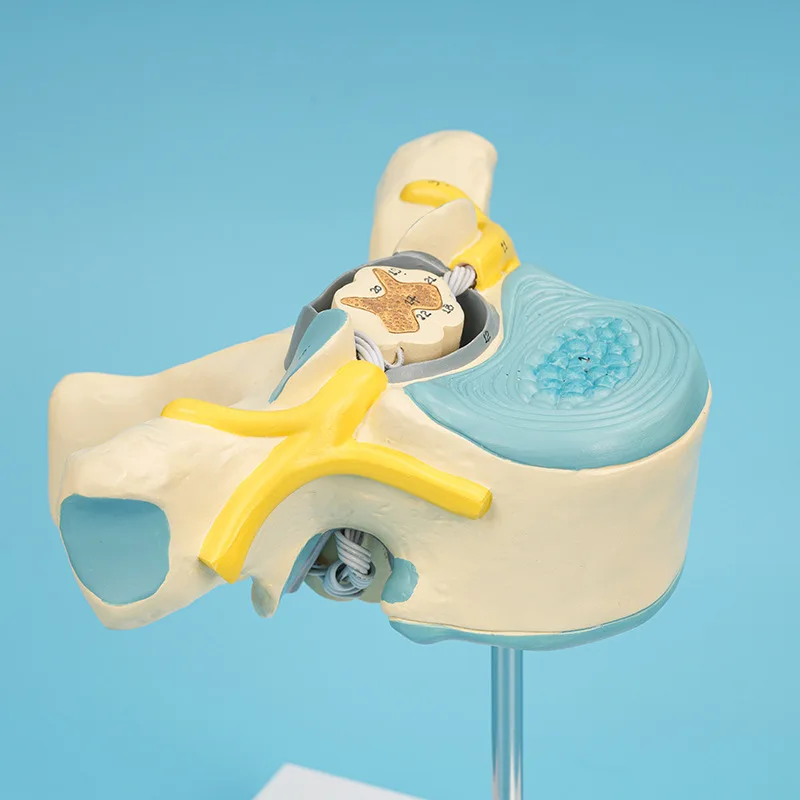 نموذج تكبير الحبل الشوكي للعمود الفقري والعمود الفقري، نموذج طبي للحبل الشوكي الصدري