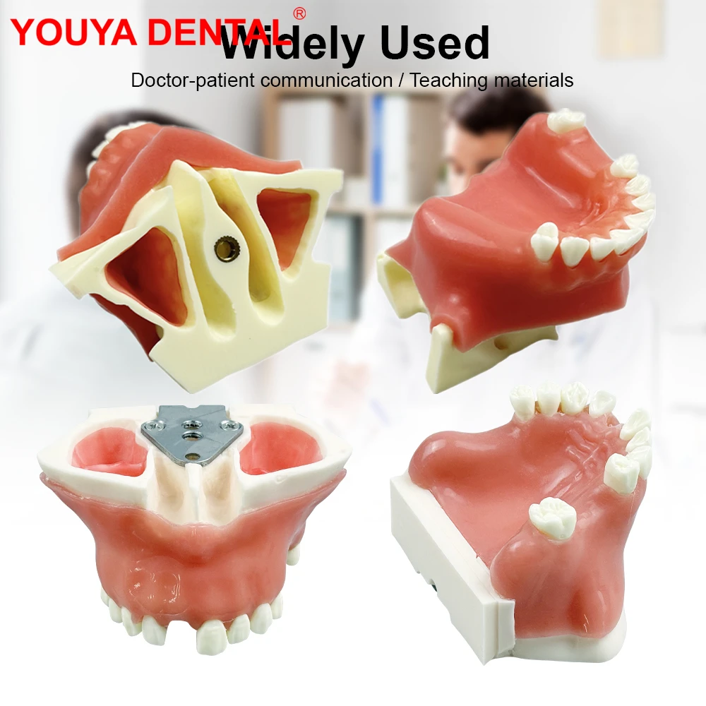 Dental Maxillary Sinus Implant Practice Model Dentistry Teeth Training Model For Studying Teaching Demo Dentist Examination Tool