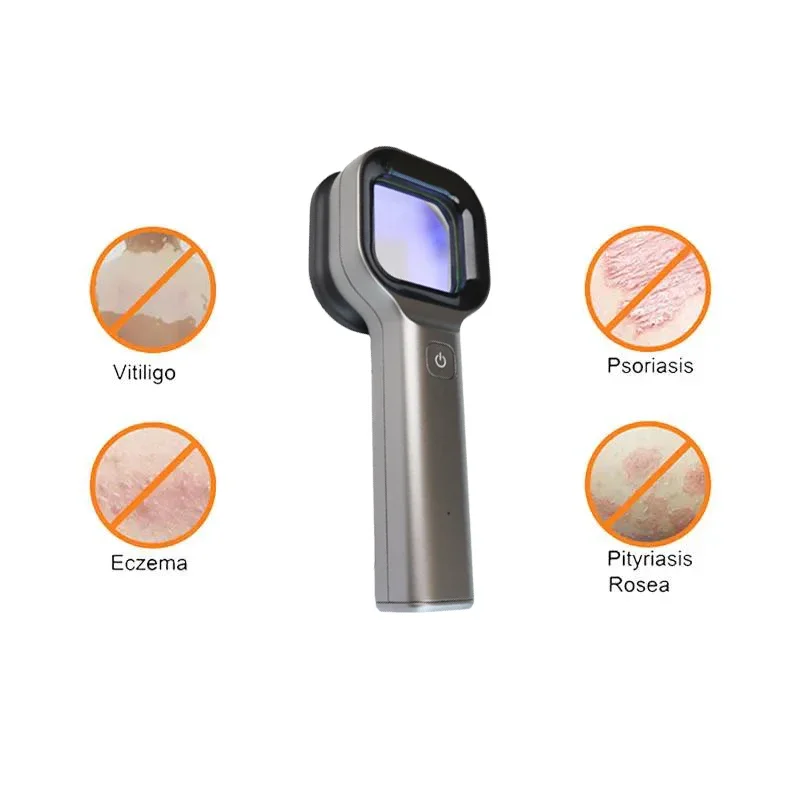 NEW Portable Woods Lamp Medical Grade Microscope Dermatoscope Rechargeable Skin Hair Analyzer