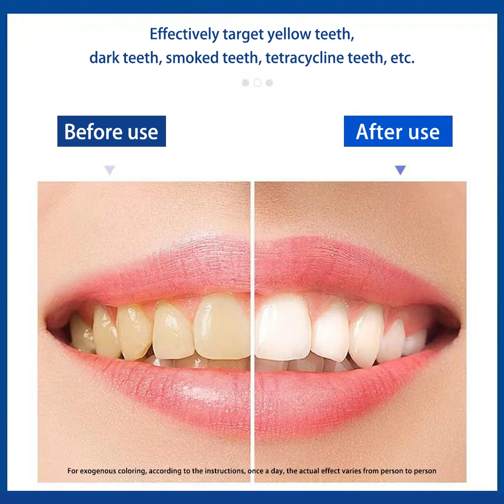 Tooth Whitening Stickers Teeth Plaque Remover Whitener Gel Strip Travel