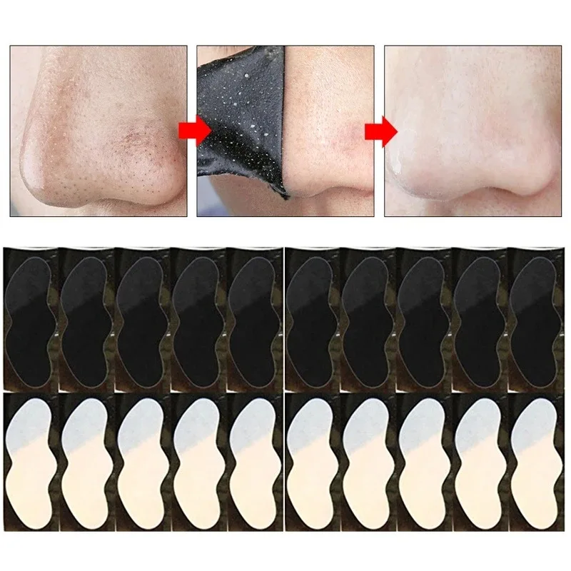 5/50 Uds eliminador de espinillas pegatina para la nariz máscara para el tratamiento del acné pegatina para la nariz de puntos negros limpiador de poros de la nariz limpieza profunda cuidado de la piel