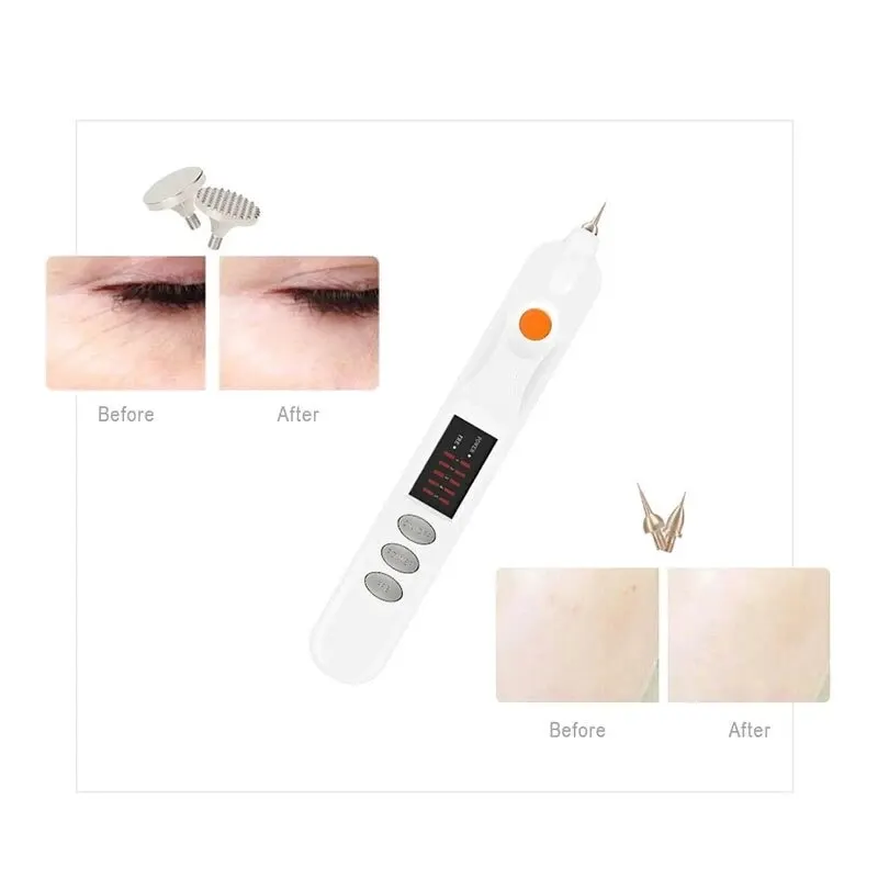 Plasma Pen Skin Mole Removal Freckle Machine Facial Wart Label Tattoo Removal Pen Blackhead Beauty Care Tool