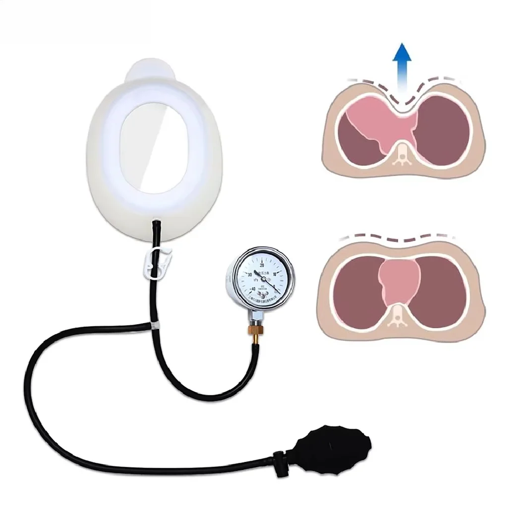 Pectus Excavatum Orthosis Brace Pectus Excavatum Vacuum Bell Sternal Depression Support Thoracic Depression Brace Sunken Sternum