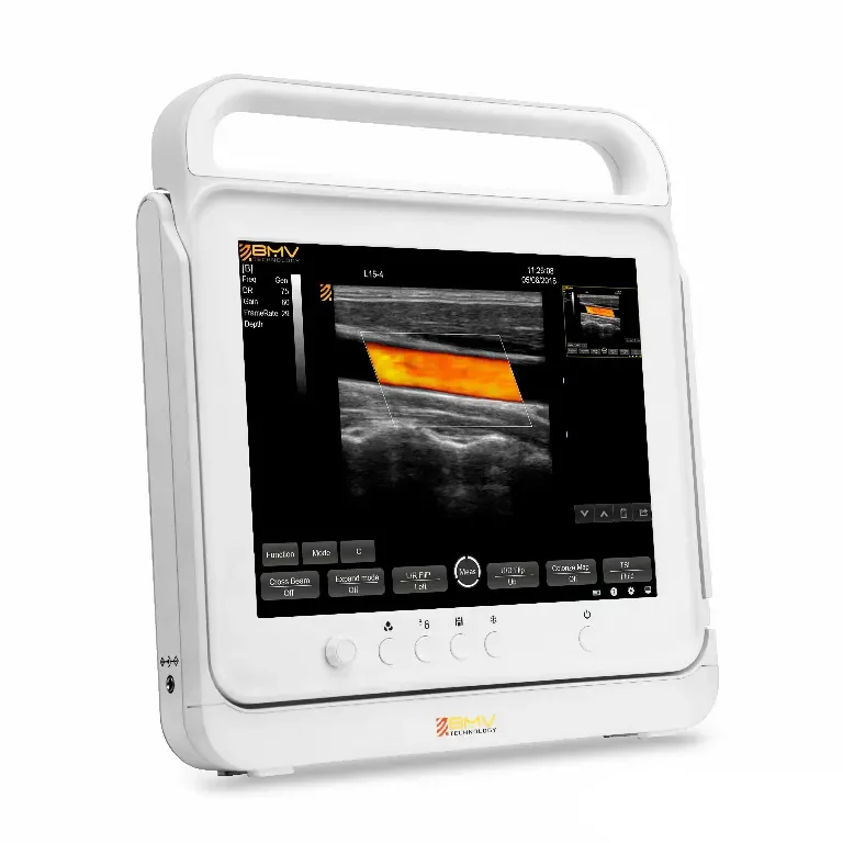 Laptop Ultrasound Scanner Portable  Vet Ultrasound Scanner Instruments Obstetrics 3D ultrasound