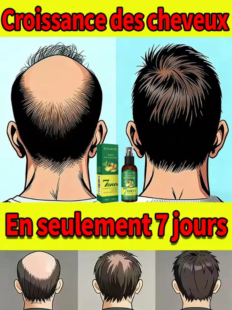 

Generation 2 Hair Growth Spray Awaken dormant hair roots, making hair thicker and fuller