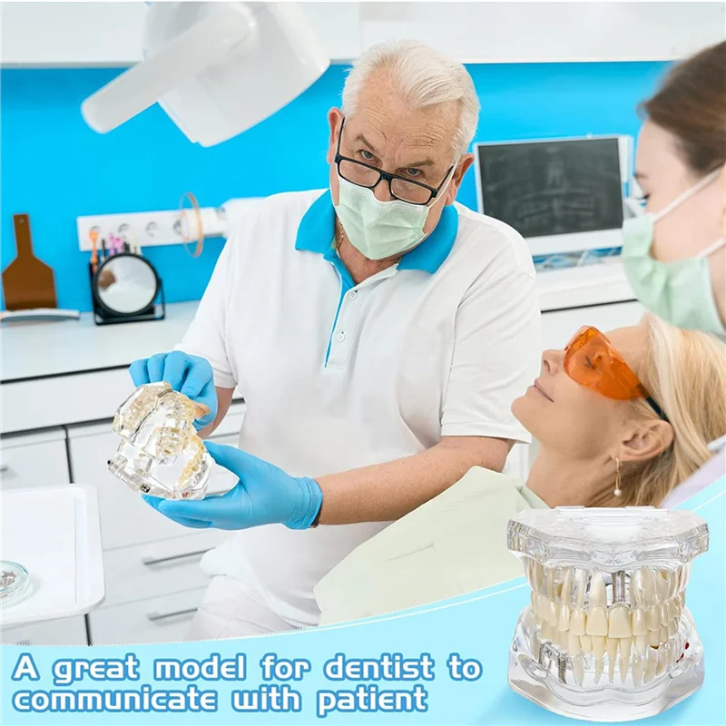 

2X модель зубов с заболеваниями Typodonts, модель зубов с имплантатом со съемными зубами, стандартная демонстрация зубов стоматолога