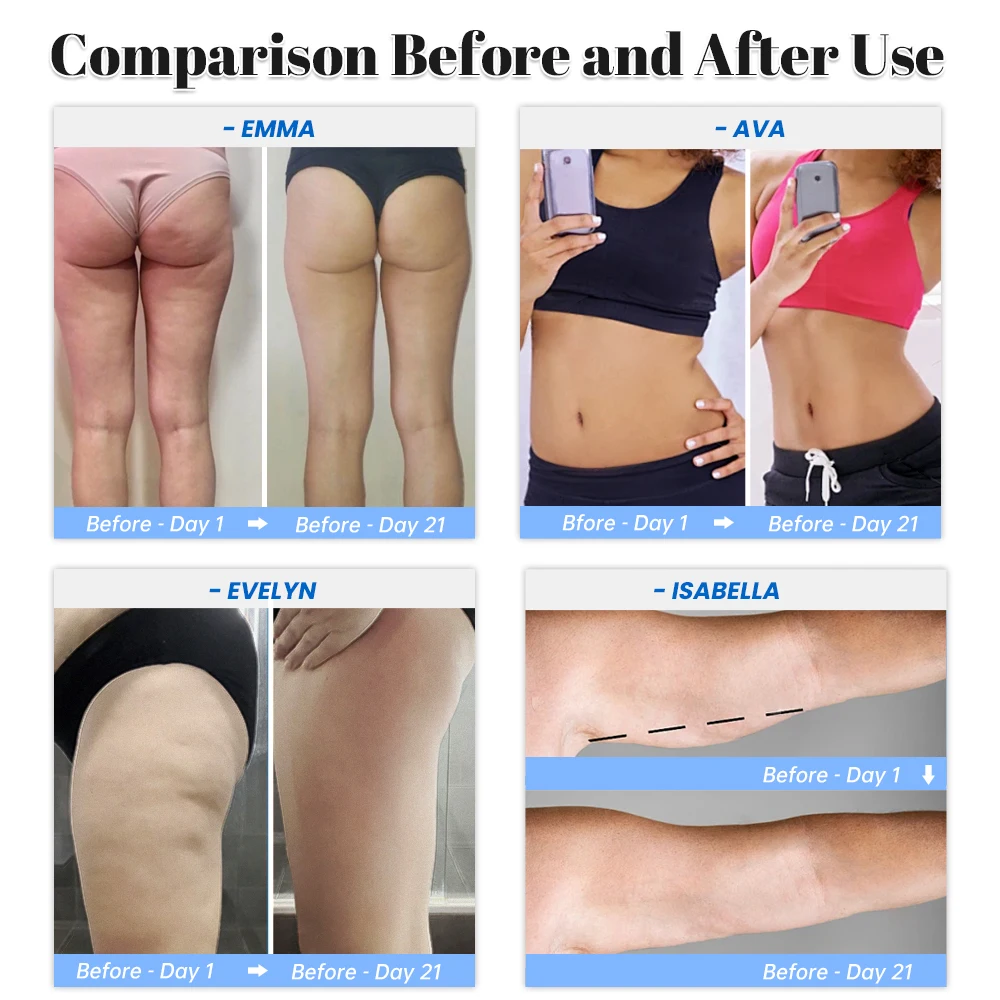 Therapie Elektrische Cupping Massager Met Rood Licht Cellulite Remover Body Sculpting Machine Draagbare Body Slimming Massager