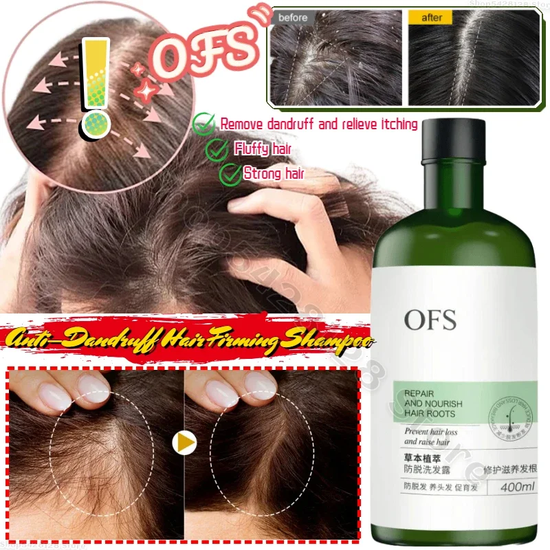 

Ofs Shampoo Oil Control Fluffy Anti-dandruff Nourishing Scalp Repair Damaged Hair Roots Solid Hair Anti-hair Loss Shampoo 400ml