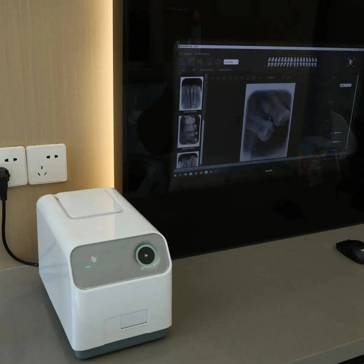 وافق CE ISO عالي الدقة 17lp/mm ماسح لوحة صورة PSP للأشعة السينية للأسنان #2