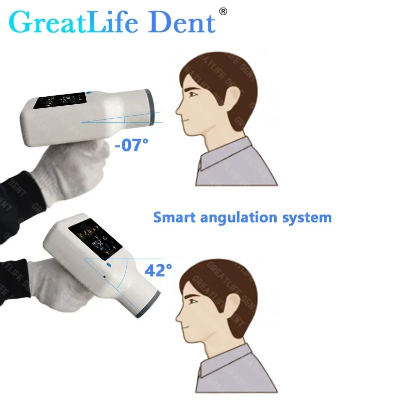 US EU MX GCC In Stock GreatLife Portable Dental Touch Screen Hyperlight AI Digital X-Ray Machine Rvg Sensor Unit Image System