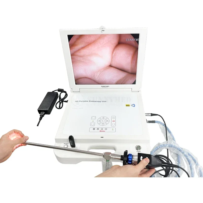 SY-PS046A Good Medical Encoscopy 17 Inch Screen Portable HD Endoscope System For Veterinary PET Endoscopy