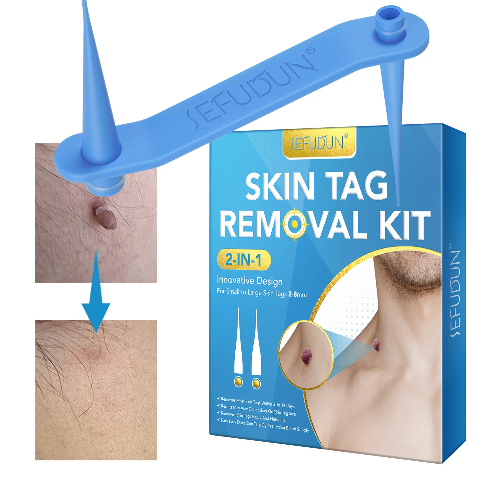 

Skin Tag Removal Kit For Small to Large Skin Tags 2-8mm for Home Use, Safe and Effective Skin Remover Bands With Cleansing Swabs