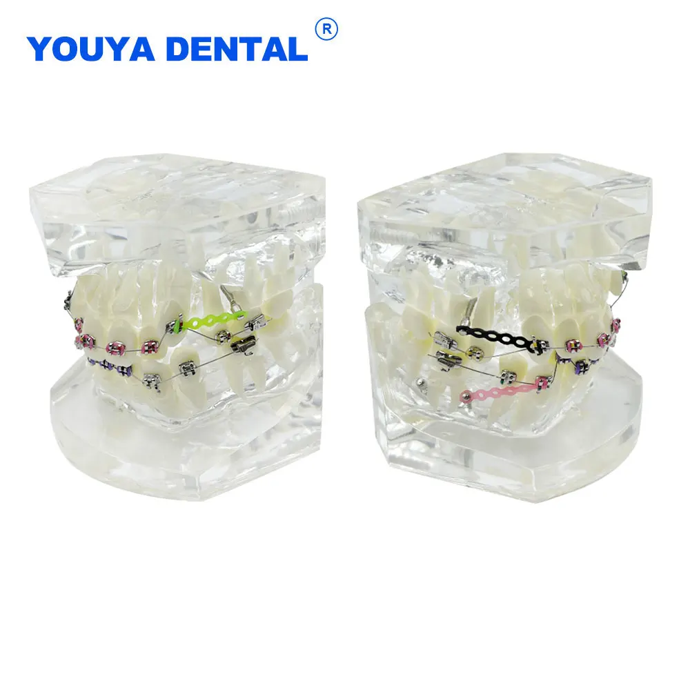 Typodont Malocclusion Orthodontic Model Study With Archwire Ligature Ties Brackets For Dentist Student Teaching Studing Demo