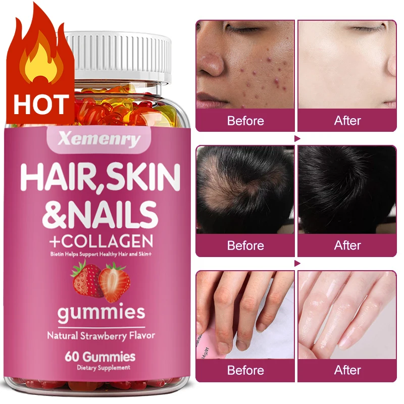 Gummies Biotin potensi tinggi untuk rambut, kulit & Kuku | Bebas Gluten, Vitamin Plus Biotin, Multivitamin rambut