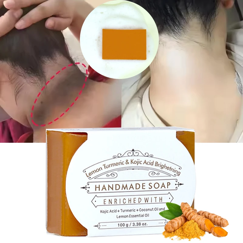 

100g Turmeric & Kojic Acid Soap Face Body Cleansing Moisturizing Whitening Skin Remove Pimples Improve Dull Skin Handmade Soap