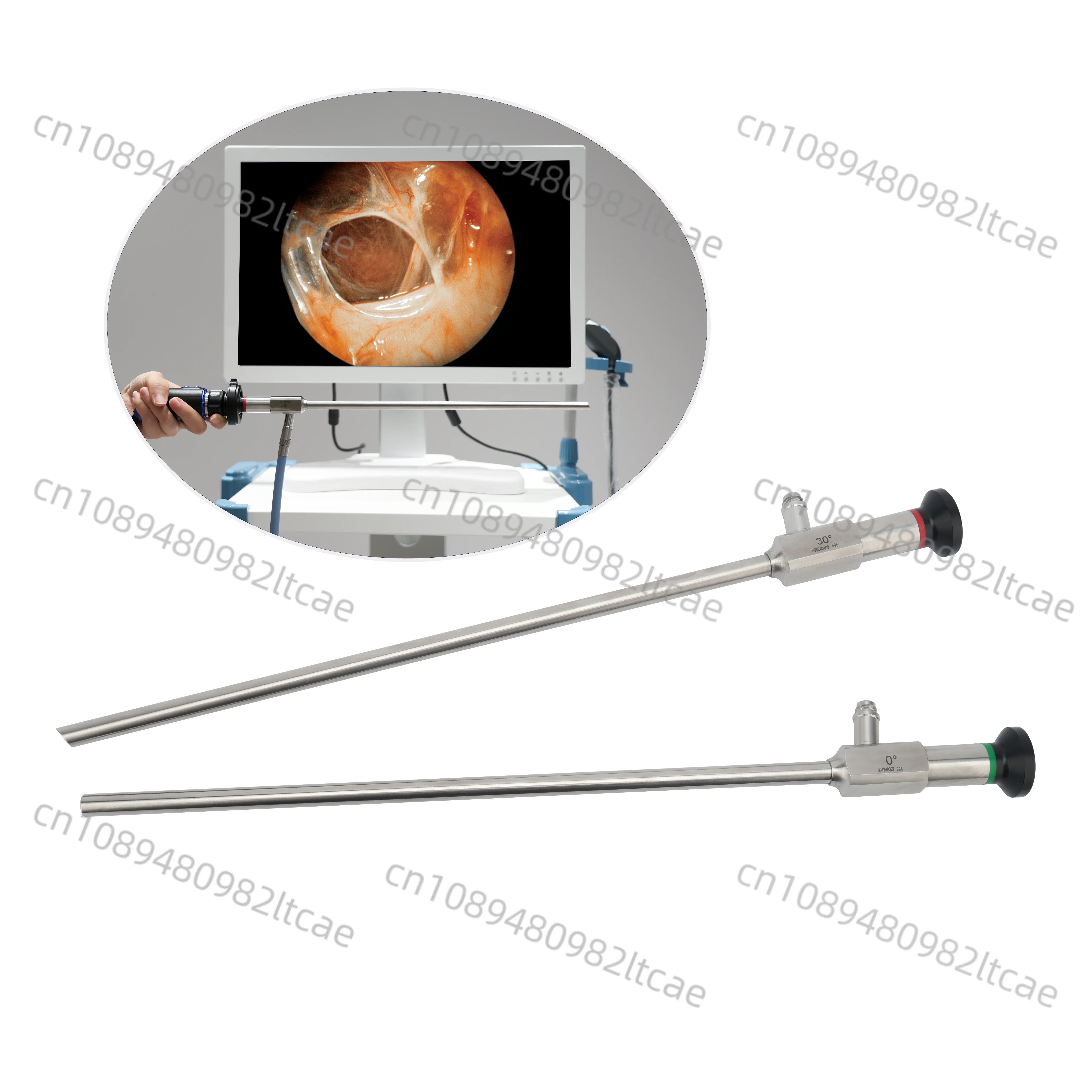 Factory Price Rigid Laparoscope,rigid Endoscope 10mm for Laparoscopy Surgery Laparoscope 10mm 30 Degree 5mm Optic Telescopes