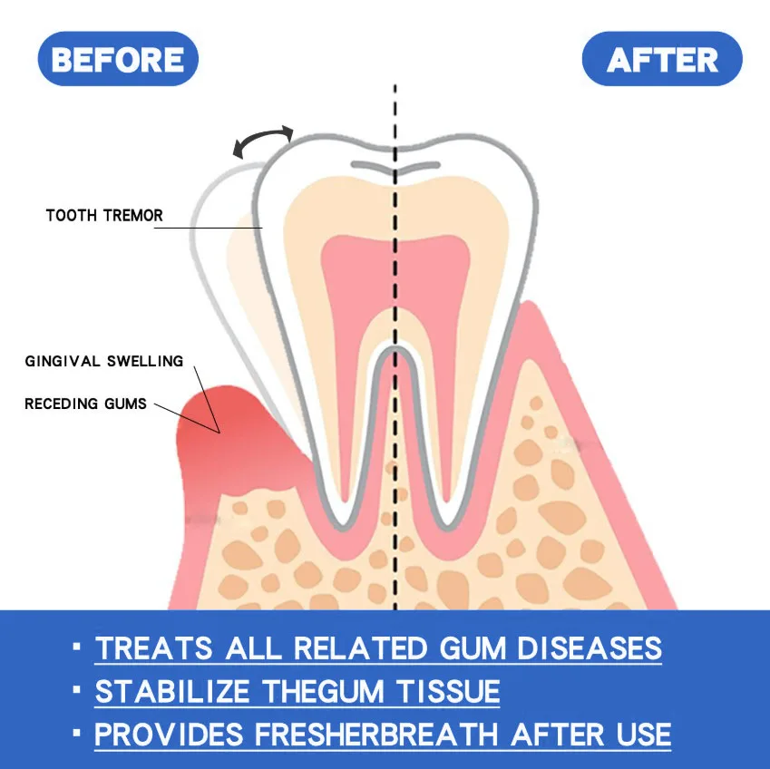 50ML Gentle Natural Gum Care Liquid Soothe Oral Discomfort Help Maintain Healthy Gum Condition Daily Oral Hygiene Care
